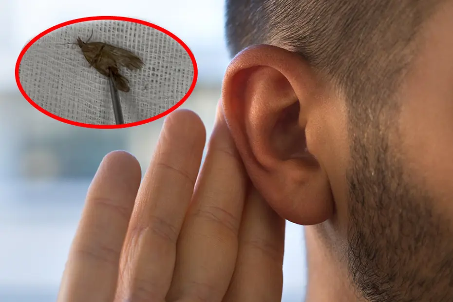 Kulaktan kelebek çıkarma