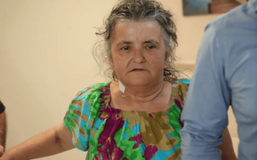 göbek fıtığı komplikasyonu