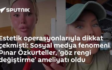 göz rengi