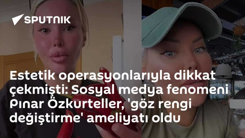 göz rengi