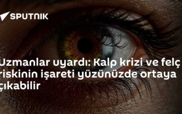 ksantelazma