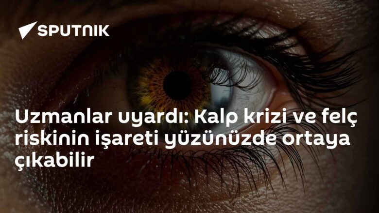 ksantelazma