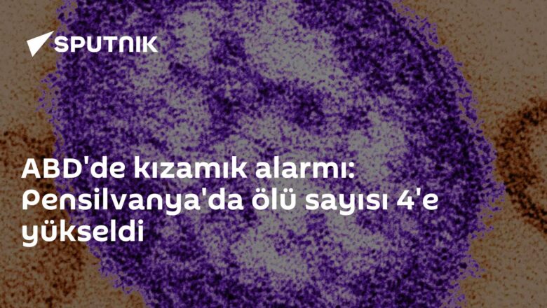 kızamık