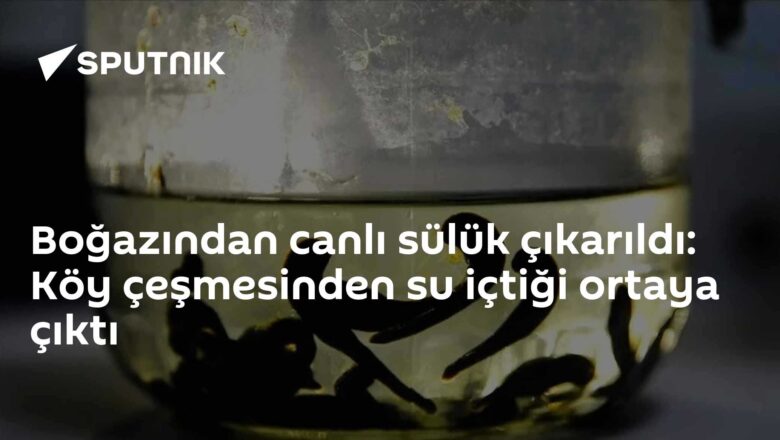 sülük