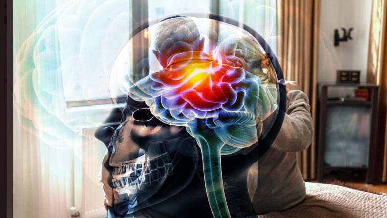 Alzheimer